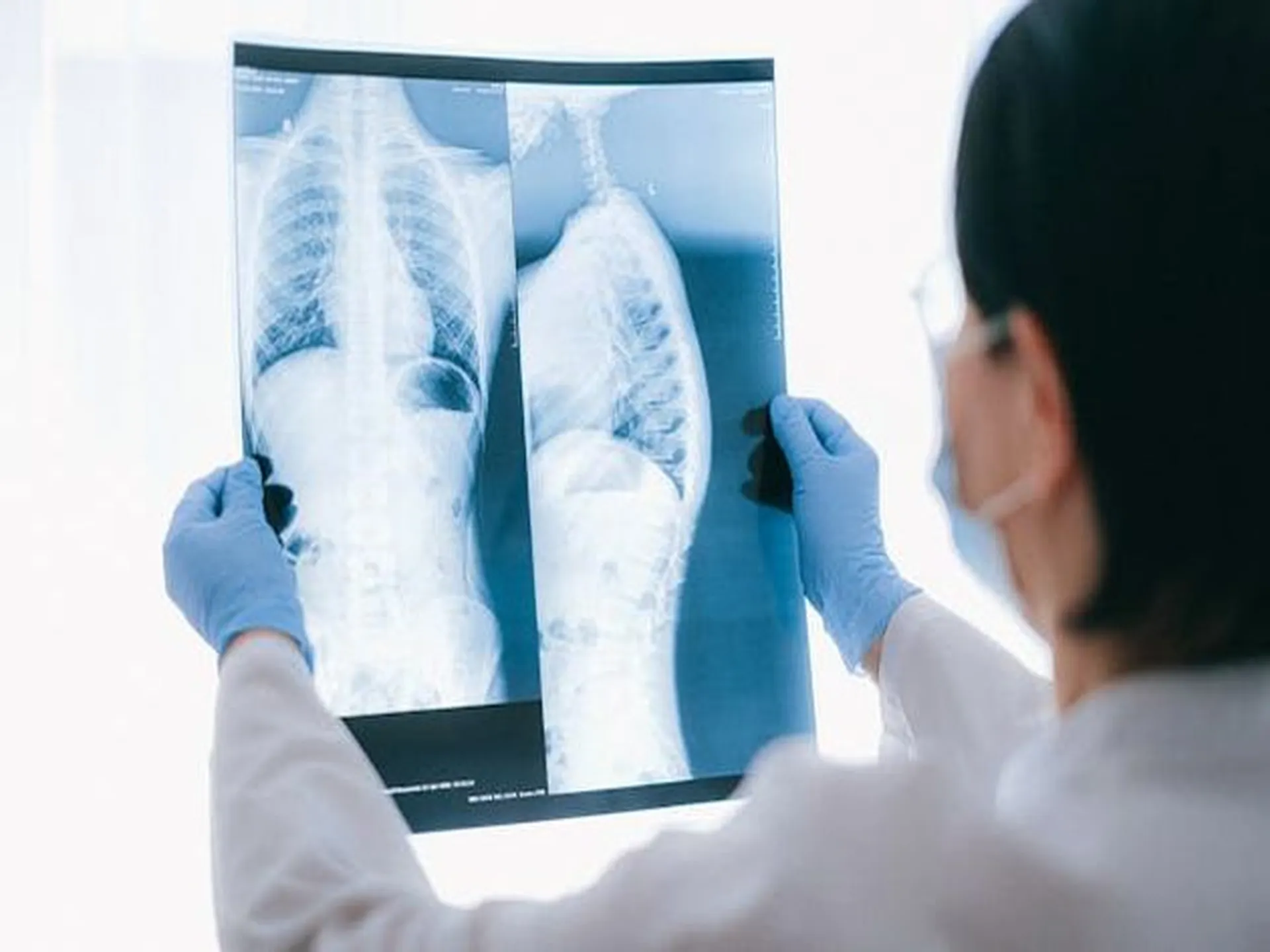 Image of a doctor reviewing a patient's x-ray image a modern Vietnam health check clinic