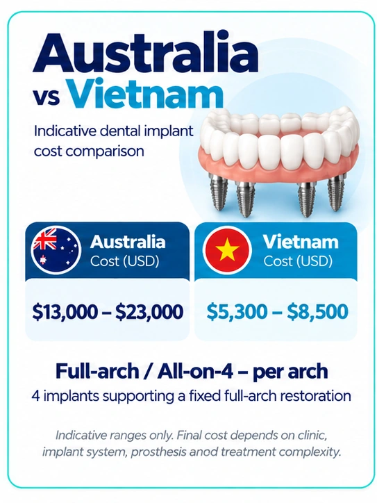 All-on-4 dental implants cost Australia vs Vietnam comparison per arch in USD