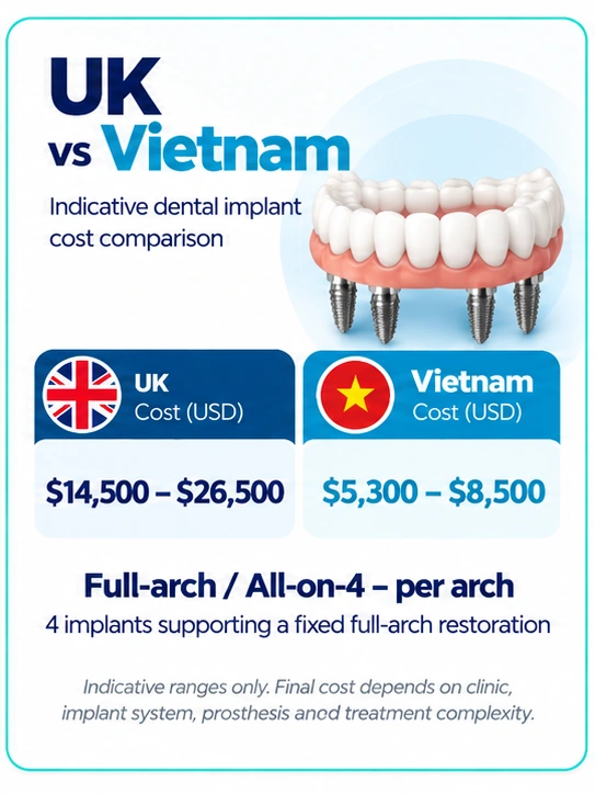All-on-4 dental implants cost UK vs Vietnam comparison per arch in USD