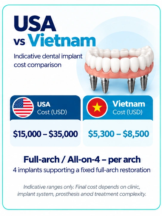 All-on-4 dental implants cost USA vs Vietnam comparison per arch in USD