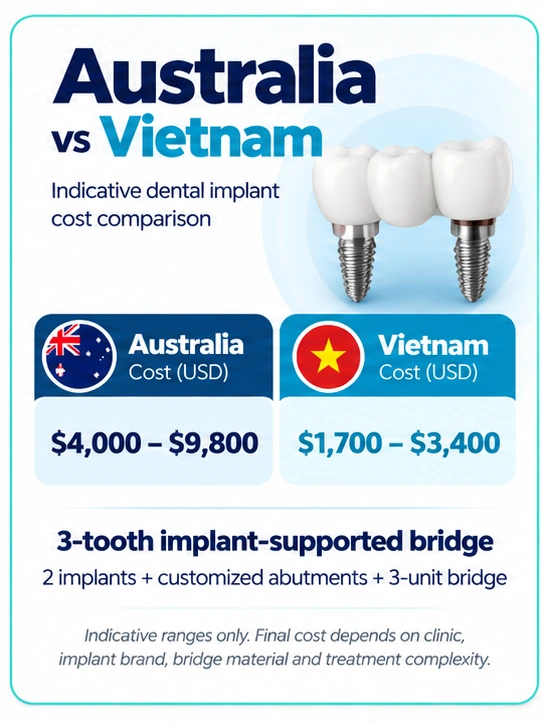 3-tooth dental implant bridge cost Australia vs Vietnam comparison in USD