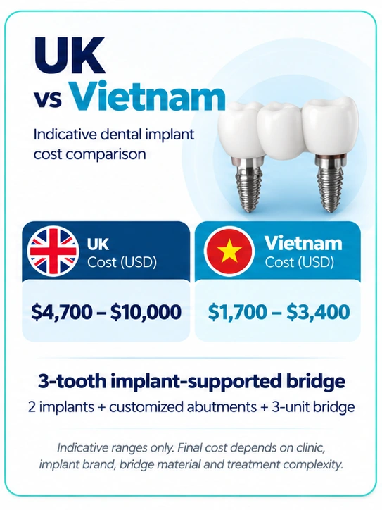 3-tooth dental implant bridge cost UK vs Vietnam comparison in USD