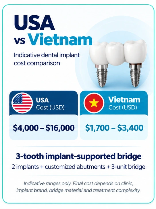 3-tooth dental implant bridge cost USA vs Vietnam comparison in USD